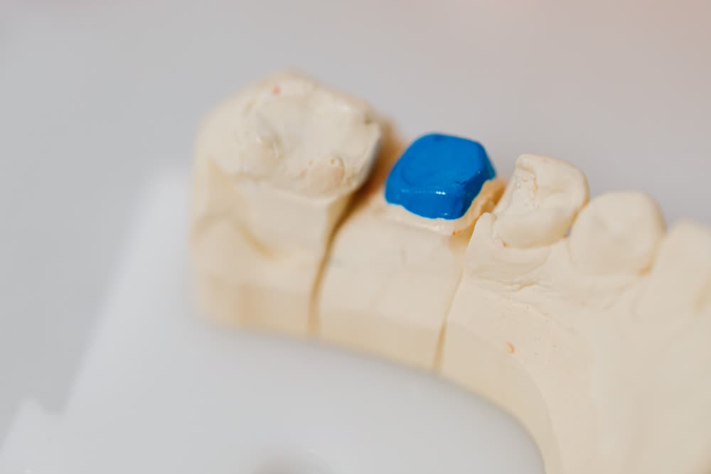 Ermiş Dental'de diş dolgusu tedavisi