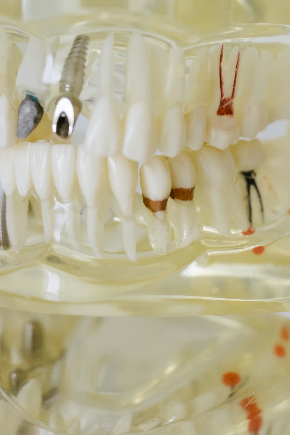 Ermiş Dental'de diş ve diş eti hastalıkları tedavisi